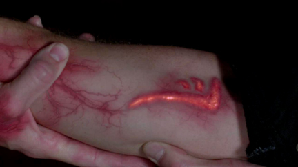 The Mark of Cain is burned into Dean's arm.